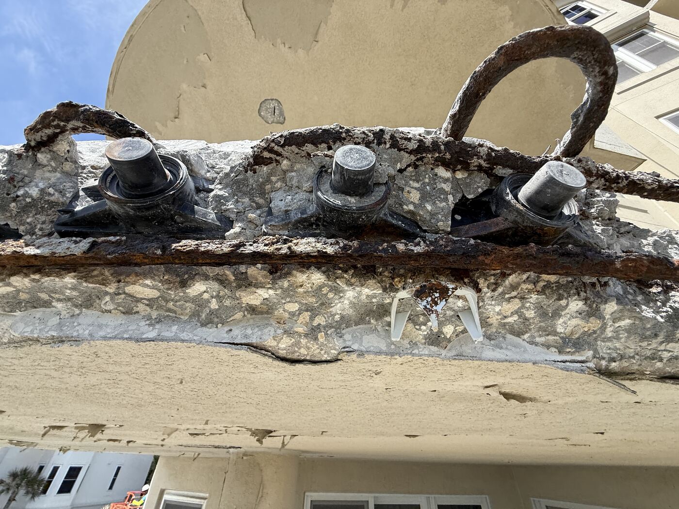 Corroded embedded steel anchor uncovered during balcony restoration at Ocean Place Condominiums